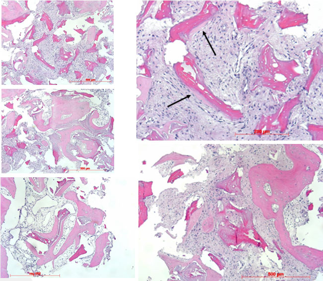 Histoloogilised vaatlused hematoksüliin-eosiin värvingu puhul (autor professor Götz)